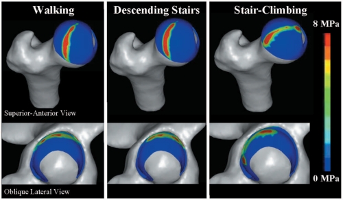 Pressure distribution across femoral head during common activities.