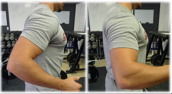 Anterior glide on left, shiny happy shoulder on right.